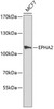 Western blot analysis of extracts of MCF-7 cells, using EPHA2 antibody (13-064) .<br/>Secondary antibody: HRP Goat Anti-Rabbit IgG (H+L) at 1:10000 dilution.<br/>Lysates/proteins: 25ug per lane.<br/>Blocking buffer: 3% nonfat dry milk in TBST.
