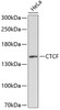 Western blot analysis of extracts of HeLa cells, using CTCF antibody (13-065) .<br/>Secondary antibody: HRP Goat Anti-Rabbit IgG (H+L) at 1:10000 dilution.<br/>Lysates/proteins: 25ug per lane.<br/>Blocking buffer: 3% nonfat dry milk in TBST.