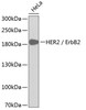 Western blot analysis of extracts of HeLa cells, using HER2 / ErbB2 antibody (13-138) .<br/>Secondary antibody: HRP Goat Anti-Rabbit IgG (H+L) at 1:10000 dilution.<br/>Lysates/proteins: 25ug per lane.<br/>Blocking buffer: 3% nonfat dry milk in TBST.