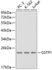 Western blot analysis of extracts of various cell lines, using GSTP1 antibody (13-149) .<br/>Secondary antibody: HRP Goat Anti-Rabbit IgG (H+L) at 1:10000 dilution.<br/>Lysates/proteins: 25ug per lane.<br/>Blocking buffer: 3% nonfat dry milk in TBST.