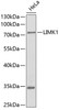 Western blot analysis of extracts of HeLa cells, using LIMK1 antibody (13-200) .<br/>Secondary antibody: HRP Goat Anti-Mouse IgG (H+L) (AS003) at 1:10000 dilution.<br/>Lysates/proteins: 25ug per lane.<br/>Blocking buffer: 3% nonfat dry milk in TBST.