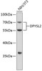 Western blot analysis of extracts of NIH/3T3 cells, using DPYSL2 antibody (13-235) .<br/>Secondary antibody: HRP Goat Anti-Mouse IgG (H+L) (AS003) at 1:10000 dilution.<br/>Lysates/proteins: 25ug per lane.<br/>Blocking buffer: 3% nonfat dry milk in TBST.