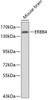 Western blot analysis of extracts of mouse brain, using ERBB4 antibody (13-274) .<br/>Secondary antibody: HRP Goat Anti-Rabbit IgG (H+L) at 1:10000 dilution.<br/>Lysates/proteins: 25ug per lane.<br/>Blocking buffer: 3% nonfat dry milk in TBST.