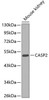 Western blot analysis of extracts of mouse kidney, using CASP2 antibody (13-287) .<br/>Secondary antibody: HRP Goat Anti-Rabbit IgG (H+L) at 1:10000 dilution.<br/>Lysates/proteins: 25ug per lane.<br/>Blocking buffer: 3% nonfat dry milk in TBST.