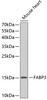 Western blot analysis of extracts of mouse heart, using FABP3 antibody (13-329) .<br/>Secondary antibody: HRP Goat Anti-Rabbit IgG (H+L) at 1:10000 dilution.<br/>Lysates/proteins: 25ug per lane.<br/>Blocking buffer: 3% nonfat dry milk in TBST.