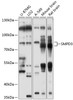 Western blot analysis of extracts of various cell lines, using SMPD3 antibody (13-492) at 1:1000 dilution.<br/>Secondary antibody: HRP Goat Anti-Rabbit IgG (H+L) at 1:10000 dilution.<br/>Lysates/proteins: 25ug per lane.<br/>Blocking buffer: 3% nonfat dry milk in TBST.<br/>Detection: ECL Basic Kit.<br/>Exposure time: 10s.