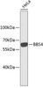 Western blot analysis of extracts of HeLa cells, using BBS4 antibody (13-705) .<br/>Secondary antibody: HRP Goat Anti-Mouse IgG (H+L) (AS003) at 1:10000 dilution.<br/>Lysates/proteins: 25ug per lane.<br/>Blocking buffer: 3% nonfat dry milk in TBST.