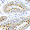 Immunohistochemistry of paraffin-embedded human colon carcinoma using FAM3B antibody (13-815) at dilution of 1:100 (40x lens) .