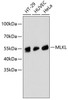 Western blot analysis of extracts of various cell lines, using MLKL antibody (14-026) .<br/>Secondary antibody: HRP Goat Anti-Rabbit IgG (H+L) at 1:10000 dilution.<br/>Lysates/proteins: 25ug per lane.<br/>Blocking buffer: 3% nonfat dry milk in TBST.