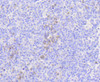 Immunohistochemistry of paraffin-embedded human tonsil using MLKL antibody (14-026) at dilution of 1:100 (40x lens) .