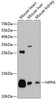 Western blot analysis of extracts of various cell lines, using NPPA antibody (14-171) at 1:1000 dilution.<br/>Secondary antibody: HRP Goat Anti-Rabbit IgG (H+L) at 1:10000 dilution.<br/>Lysates/proteins: 25ug per lane.<br/>Blocking buffer: 3% nonfat dry milk in TBST.<br/>Detection: ECL Basic Kit.<br/>Exposure time: 90s.