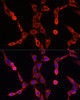 Immunofluorescence analysis of NIH/3T3 cells using ABCD1 antibody (14-276) at dilution of 1:100. Blue: DAPI for nuclear staining.