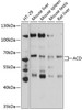 Western blot analysis of extracts of various cell lines, using ACD antibody (14-296) at 1:3000 dilution.<br/>Secondary antibody: HRP Goat Anti-Rabbit IgG (H+L) at 1:10000 dilution.<br/>Lysates/proteins: 25ug per lane.<br/>Blocking buffer: 3% nonfat dry milk in TBST.<br/>Detection: ECL Basic Kit.<br/>Exposure time: 10s.