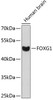 Western blot analysis of extracts of human brain, using FOXG1 antibody (14-393) .<br/>Secondary antibody: HRP Goat Anti-Rabbit IgG (H+L) at 1:10000 dilution.<br/>Lysates/proteins: 25ug per lane.<br/>Blocking buffer: 3% nonfat dry milk in TBST.