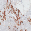 Immunohistochemistry of paraffin-embedded human breast using ELN antibody (14-419) at dilution of 1:100 (40x lens) .