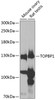 Western blot analysis of extracts of various cell lines, using TOPBP1 antibody (14-513) at 1:1000 dilution.<br/>Secondary antibody: HRP Goat Anti-Rabbit IgG (H+L) at 1:10000 dilution.<br/>Lysates/proteins: 25ug per lane.<br/>Blocking buffer: 3% nonfat dry milk in TBST.<br/>Detection: ECL Enhanced Kit.<br/>Exposure time: 50s.