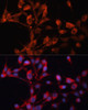 Immunofluorescence analysis of NIH/3T3 cells using SLC25A19 antibody (14-602) at dilution of 1:100. Blue: DAPI for nuclear staining.