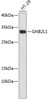 Western blot analysis of extracts of HT-29 cells, using GNB2L1 antibody (14-611) .<br/>Secondary antibody: HRP Goat Anti-Rabbit IgG (H+L) at 1:10000 dilution.<br/>Lysates/proteins: 25ug per lane.<br/>Blocking buffer: 3% nonfat dry milk in TBST.