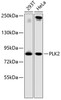 Western blot analysis of extracts of various cell lines, using PLK2 antibody (14-629) .<br/>Secondary antibody: HRP Goat Anti-Rabbit IgG (H+L) at 1:10000 dilution.<br/>Lysates/proteins: 25ug per lane.<br/>Blocking buffer: 3% nonfat dry milk in TBST.