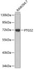 Western blot analysis of extracts of raw264.7 cells, using PTGS2 antibody (14-638) .<br/>Secondary antibody: HRP Goat Anti-Rabbit IgG (H+L) at 1:10000 dilution.<br/>Lysates/proteins: 25ug per lane.<br/>Blocking buffer: 3% nonfat dry milk in TBST.