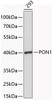 Western blot analysis of extracts of 293 cells, using PON1 antibody (14-847) .<br/>Secondary antibody: HRP Goat Anti-Rabbit IgG (H+L) at 1:10000 dilution.<br/>Lysates/proteins: 25ug per lane.<br/>Blocking buffer: 3% nonfat dry milk in TBST.