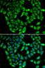 Immunofluorescence analysis of HeLa cells using ASIP antibody (14-885) . Blue: DAPI for nuclear staining.