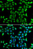 Immunofluorescence analysis of U2OS cells using DNAJA3 antibody (14-965) . Blue: DAPI for nuclear staining.