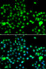 Immunofluorescence analysis of A549 cells using IP6K2 antibody (14-983) . Blue: DAPI for nuclear staining.