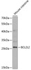 Western blot analysis of extracts of mouse intestine, using BCL2L2 antibody (15-008) at 1:1000 dilution.<br/>Secondary antibody: HRP Goat Anti-Rabbit IgG (H+L) at 1:10000 dilution.<br/>Lysates/proteins: 25ug per lane.<br/>Blocking buffer: 3% nonfat dry milk in TBST.<br/>Detection: ECL Basic Kit.<br/>Exposure time: 30s.