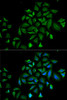 Immunofluorescence analysis of HeLa cells using FGFR1 antibody (15-021) . Blue: DAPI for nuclear staining.