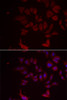 Immunofluorescence analysis of MCF-7 cells using RPL11 antibody (15-058) . Blue: DAPI for nuclear staining.