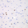 Immunohistochemistry of paraffin-embedded rat brain using TKT antibody (15-065) at dilution of 1:100 (40x lens) .