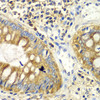 Immunohistochemistry of paraffin-embedded human colon using PICK1 antibody (15-078) at dilution of 1:100 (40x lens) .