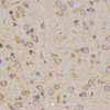 Immunohistochemistry of paraffin-embedded rat brain using Eif2ak2 antibody (15-086) at dilution of 1:200 (40x lens) .