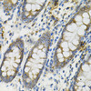 Immunohistochemistry of paraffin-embedded human colon using DEFB132 antibody (15-151) at dilution of 1:100 (40x lens) .