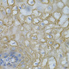 Immunohistochemistry of paraffin-embedded human esophagus using DEFB132 antibody (15-151) at dilution of 1:100 (40x lens) .