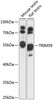 Western blot analysis of extracts of various cell lines, using TRIM59 antibody (15-246) at 1:1000 dilution.<br/>Secondary antibody: HRP Goat Anti-Rabbit IgG (H+L) at 1:10000 dilution.<br/>Lysates/proteins: 25ug per lane.<br/>Blocking buffer: 3% nonfat dry milk in TBST.<br/>Detection: ECL Basic Kit.<br/>Exposure time: 90s.