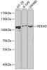 Western blot analysis of extracts of various cell lines, using PDE4D antibody (15-277) at 1:1000 dilution.<br/>Secondary antibody: HRP Goat Anti-Rabbit IgG (H+L) at 1:10000 dilution.<br/>Lysates/proteins: 25ug per lane.<br/>Blocking buffer: 3% nonfat dry milk in TBST.
