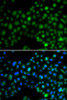 Immunofluorescence analysis of MCF-7 cells using NFIL3 antibody (15-329) . Blue: DAPI for nuclear staining.