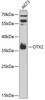 Western blot analysis of extracts of A-673 cells, using OTX2 antibody (15-334) at 1:1000 dilution.<br/>Secondary antibody: HRP Goat Anti-Rabbit IgG (H+L) at 1:10000 dilution.<br/>Lysates/proteins: 25ug per lane.<br/>Blocking buffer: 3% nonfat dry milk in TBST.<br/>Detection: ECL Basic Kit.<br/>Exposure time: 60s.