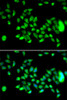 Immunofluorescence analysis of U2OS cells using HYAL3 antibody (15-358) . Blue: DAPI for nuclear staining.