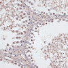 Immunohistochemistry of paraffin-embedded rat testis using CCNE2 antibody (15-363) at dilution of 1:100 (40x lens) .