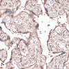 Immunohistochemistry of paraffin-embedded human placenta using CCNE2 antibody (15-363) at dilution of 1:100 (40x lens) .