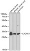 Western blot analysis of extracts of various cell lines, using CACNG4 antibody (15-380) at 1:1000 dilution.<br/>Secondary antibody: HRP Goat Anti-Rabbit IgG (H+L) at 1:10000 dilution.<br/>Lysates/proteins: 25ug per lane.<br/>Blocking buffer: 3% nonfat dry milk in TBST.<br/>Detection: ECL Enhanced Kit.<br/>Exposure time: 90s.