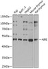 Western blot analysis of extracts of various cell lines, using AIRE antibody (15-413) at 1:1000 dilution.<br/>Secondary antibody: HRP Goat Anti-Rabbit IgG (H+L) at 1:10000 dilution.<br/>Lysates/proteins: 25ug per lane.<br/>Blocking buffer: 3% nonfat dry milk in TBST.<br/>Detection: ECL Basic Kit.<br/>Exposure time: 1s.