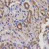 Immunohistochemistry of paraffin-embedded rat kidney using EPHX2 antibody (15-424) at dilution of 1:200 (40x lens) .