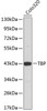 Western blot analysis of extracts of COLO320 cells, using TBP antibody (15-439) .<br/>Secondary antibody: HRP Goat Anti-Rabbit IgG (H+L) at 1:10000 dilution.<br/>Lysates/proteins: 25ug per lane.<br/>Blocking buffer: 3% nonfat dry milk in TBST.