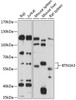 Western blot analysis of extracts of various cell lines, using BTN3A3 antibody (15-458) at 1:1000 dilution.<br/>Secondary antibody: HRP Goat Anti-Rabbit IgG (H+L) at 1:10000 dilution.<br/>Lysates/proteins: 25ug per lane.<br/>Blocking buffer: 3% nonfat dry milk in TBST.<br/>Detection: ECL Basic Kit.<br/>Exposure time: 30s.