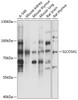 Western blot analysis of extracts of various cell lines, using SLCO3A1 antibody (15-462) at 1:3000 dilution.<br/>Secondary antibody: HRP Goat Anti-Rabbit IgG (H+L) at 1:10000 dilution.<br/>Lysates/proteins: 25ug per lane.<br/>Blocking buffer: 3% nonfat dry milk in TBST.<br/>Detection: ECL Basic Kit.<br/>Exposure time: 1s.