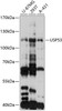 Western blot analysis of extracts of various cell lines, using USP53 antibody (15-496) at 1:3000 dilution.<br/>Secondary antibody: HRP Goat Anti-Rabbit IgG (H+L) at 1:10000 dilution.<br/>Lysates/proteins: 25ug per lane.<br/>Blocking buffer: 3% nonfat dry milk in TBST.<br/>Detection: ECL Basic Kit.<br/>Exposure time: 20s.